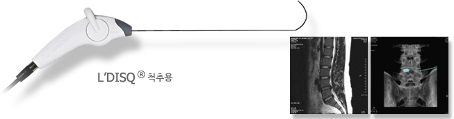 L'DISQ 척추용