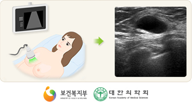 유방초음파검사